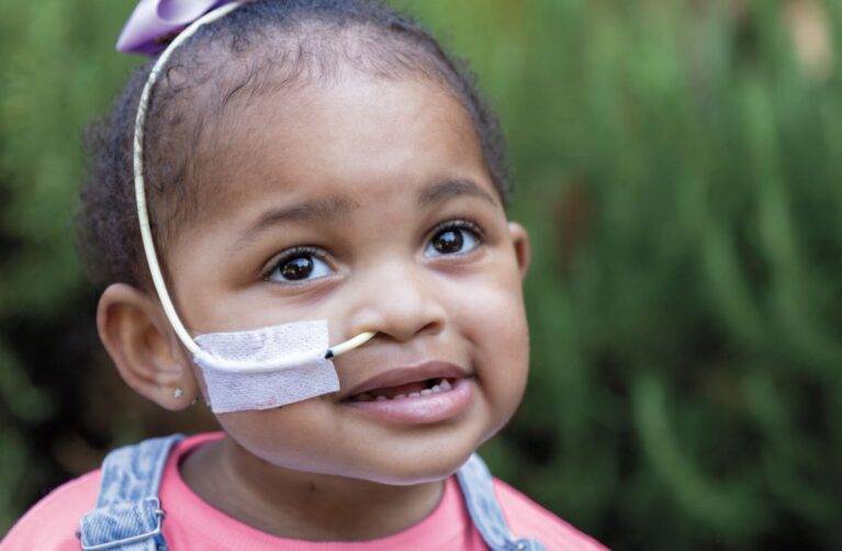 2-year-old heart patient smiling