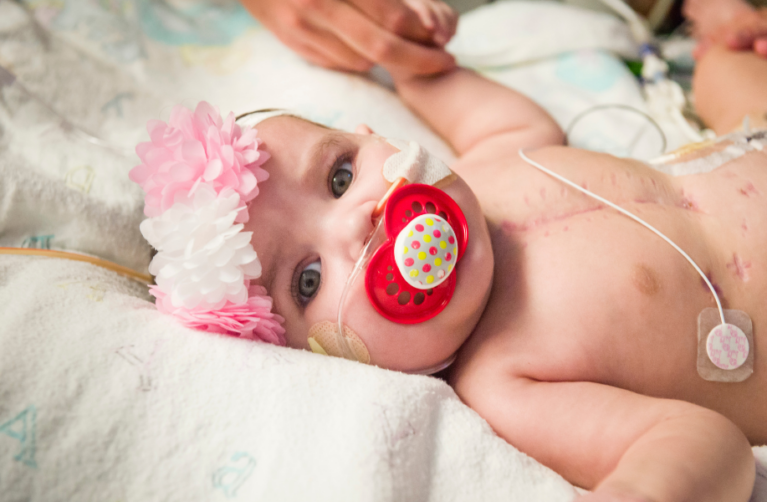 Lucile Packard Children's Hospital Stanford infant heart patient in their hospital bed looking at the camera with a pacifier in their mouth.