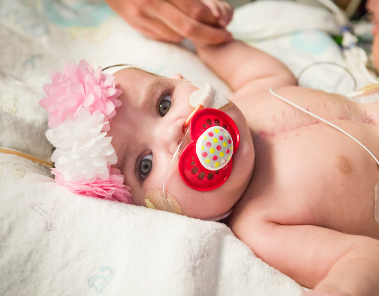Lucile Packard Children's Hospital Stanford infant heart patient in their hospital bed looking at the camera with a pacifier in their mouth.