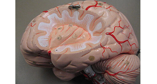 brain