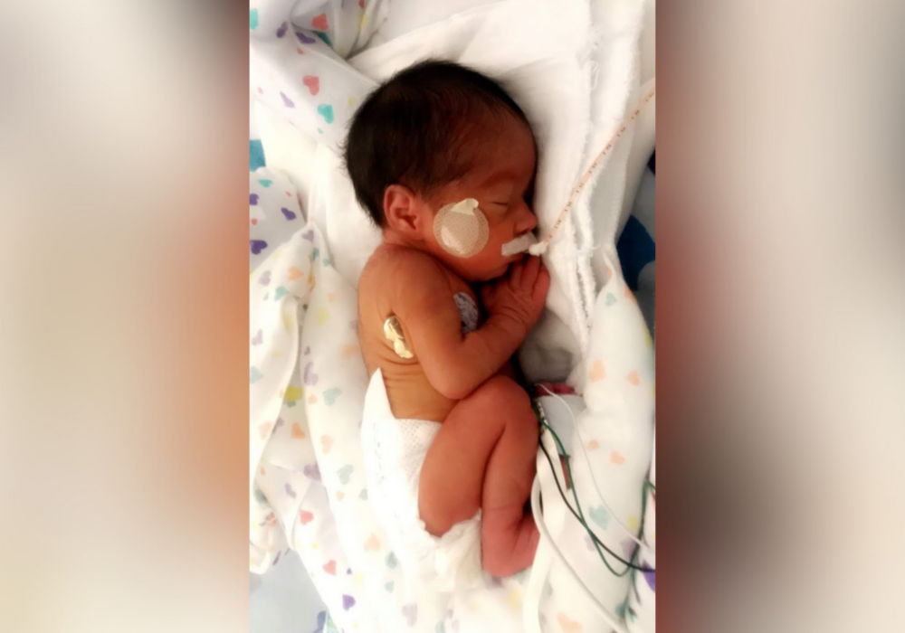 Iliana as a premature baby in NICU.
