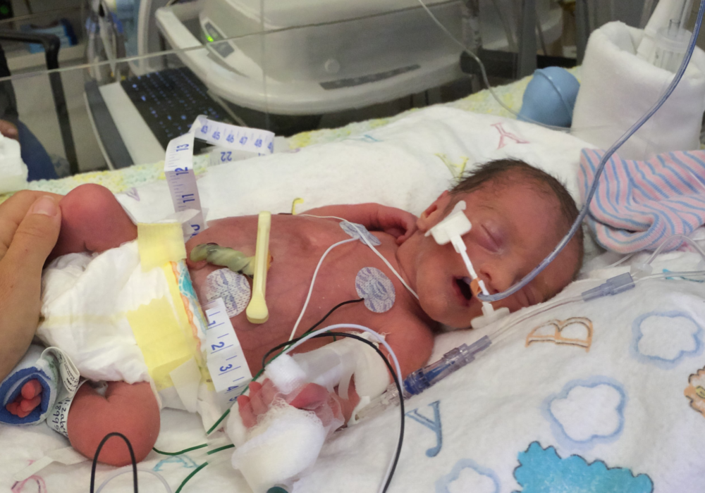 NICU Baby