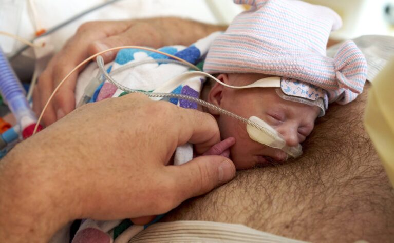 (This photo was retouched to reduce hair covering baby's mouth and face.)  
Austen Tabone's mother went into premature labor, and Austen was born at a hospital in Santa Cruz. The neonatologist there determined Austen had esophageal abnormalities and had her admitted to the Packard Children's NICU. There Austen underwent a procedure to correct her esophageal issue, but then the Packard Children's team discovered Austen had Tetraology of Fallot. Austen, at less than two months of age, underwent open-heart surgery at our hospital. Today Austen is back at home and doing well.