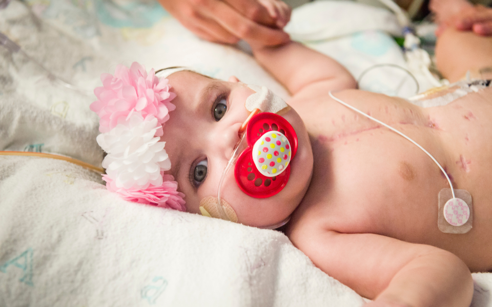 Lucile Packard Children's Hospital Stanford infant heart patient in their hospital bed looking at the camera with a pacifier in their mouth.