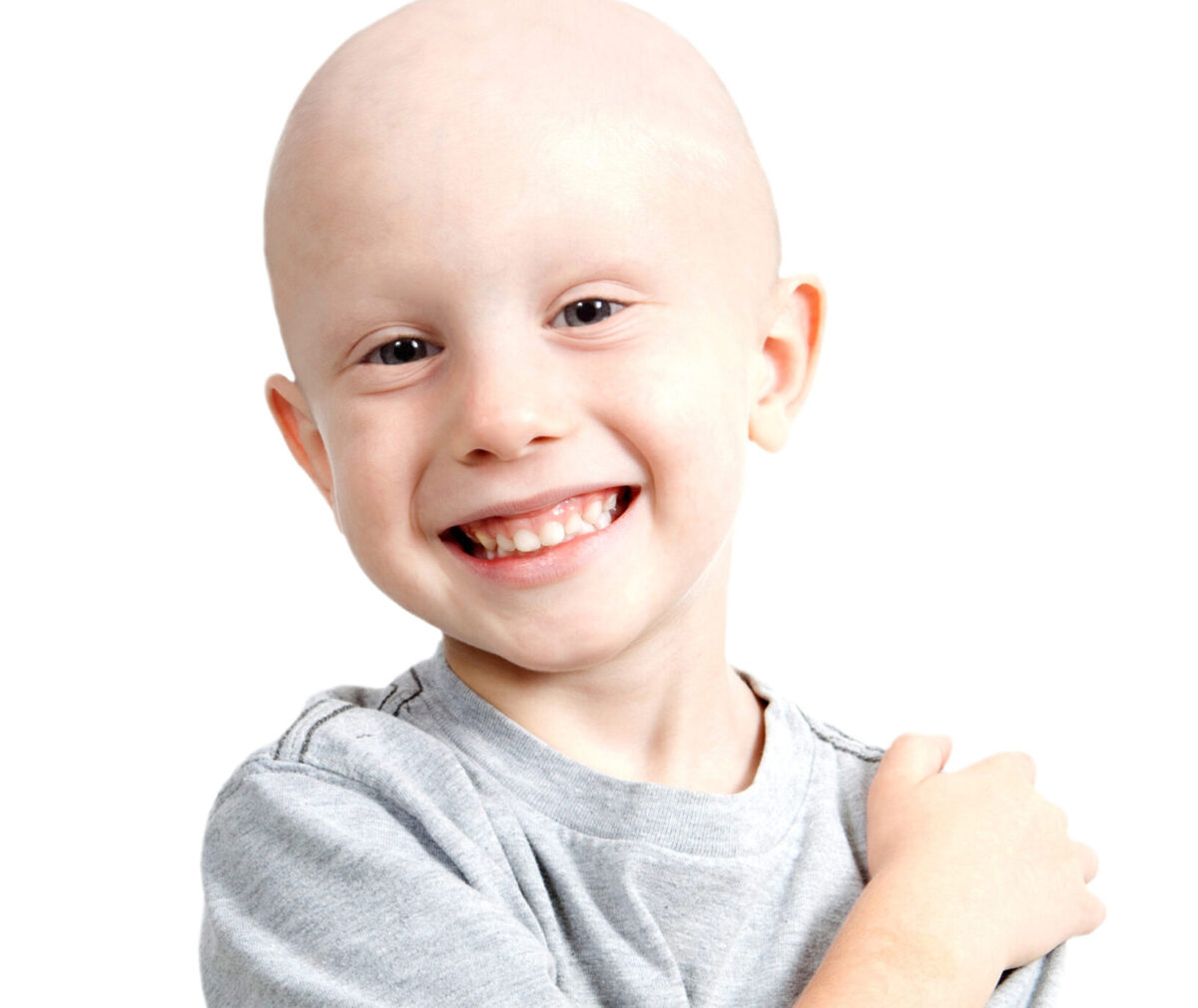 A young child with no hair is posing with a smile.