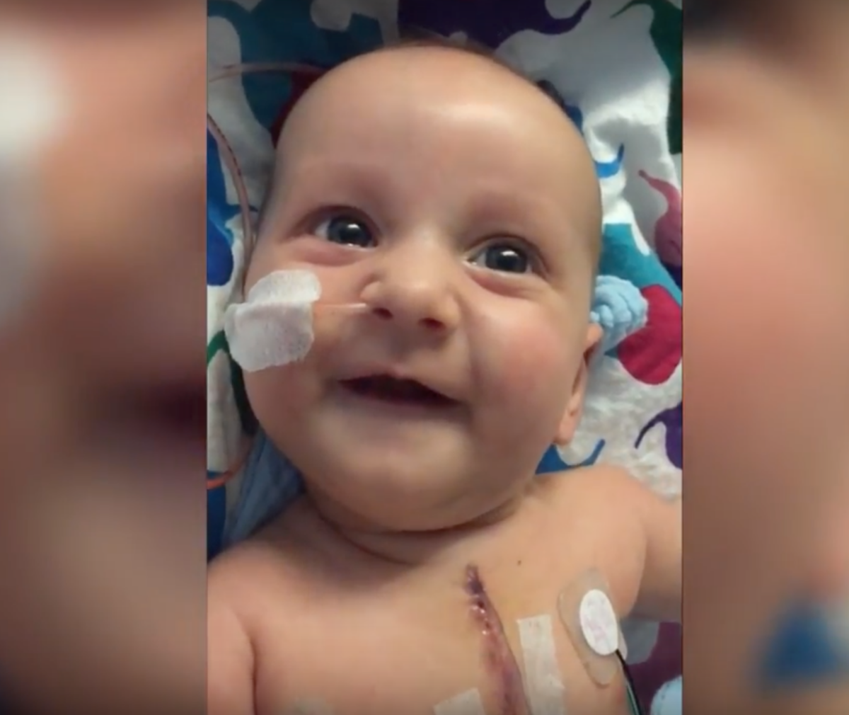 Baby patient looking at camera.